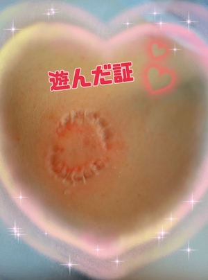 翔
